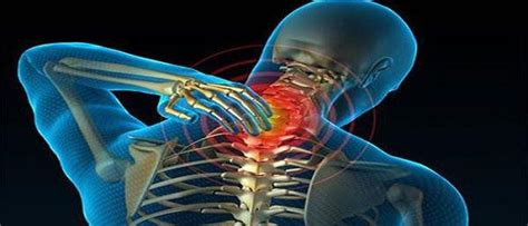 midokalm как да приемаме при остеохондроза на шийния отдел на гръбначния стълб